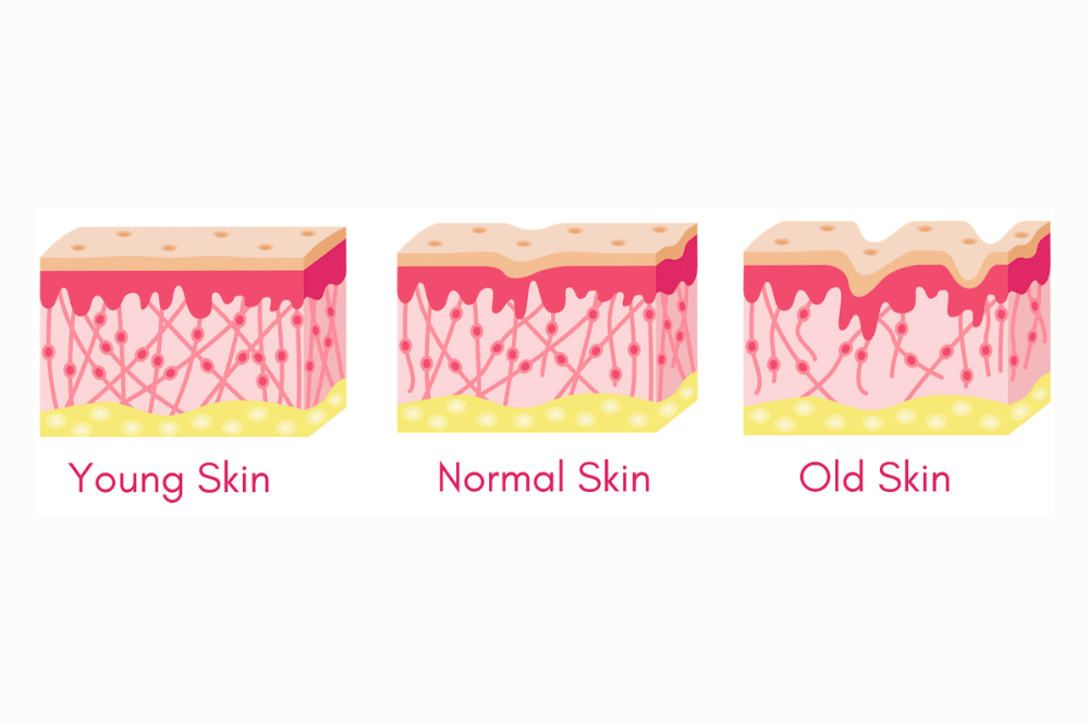 A graphic showing the natural decline in collagen in a woman's skin.