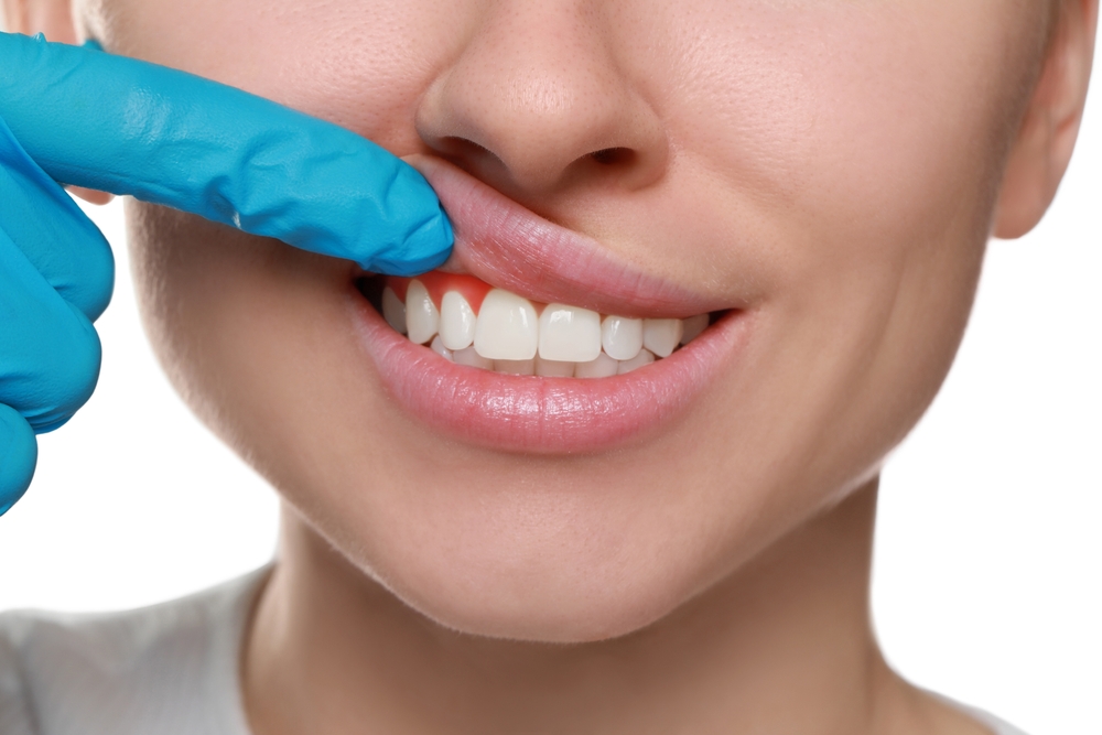 A dentist's hand looking at a woman's gums.